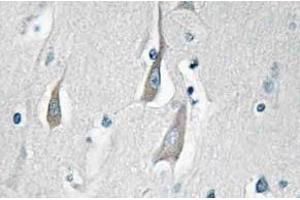 Immunohistochemistry (IHC) analyzes of p-CaMKIIalpha/delta antibody in paraffin-embedded human brain tissue. (CAMK2A antibody  (pThr286))