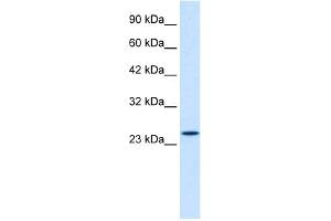 WB Suggested Anti-ZNF22 Antibody Titration:  1.
