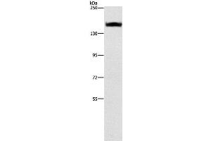 Western Blot analysis of A431 cell using ITGA2 Polyclonal Antibody at dilution of 1:300 (ITGA2 antibody)
