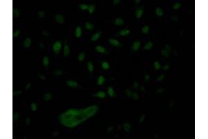 Immunofluorescence staining of Hela Cells with ABIN7127649 at 1:50, counter-stained with DAPI. (Recombinant NUP153 antibody)