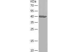 Western Blotting (WB) image for Cell Migration Inducing Hyaluronan Binding Protein (CEMIP) (AA 37-218) protein (His-IF2DI Tag) (ABIN7122234) (CEMIP Protein (AA 37-218) (His-IF2DI Tag))