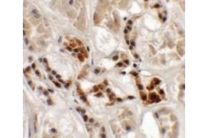 Immunohistochemistry (IHC) image for anti-Adaptor-Related Protein Complex 3, sigma 1 Subunit (AP3S1) (Middle Region) antibody (ABIN1030856) (AP3S1 antibody  (Middle Region))