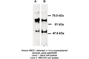 Image no. 1 for anti-ATP-Binding Cassette, Sub-Family E (OABP), Member 1 (ABCE1) (AA 1-119) antibody (ABIN363408) (ABCE1 antibody  (AA 1-119))