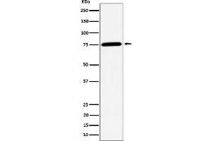 Western blot analysis of PPM1G expression in Jurkat cell lysate. (Recombinant PPM1G antibody)