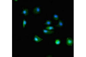 Immunofluorescent analysis of MCF-7 cells using ABIN7171915 at dilution of 1:100 and Alexa Fluor 488-congugated AffiniPure Goat Anti-Rabbit IgG(H+L) (TTC19 antibody  (AA 108-380))