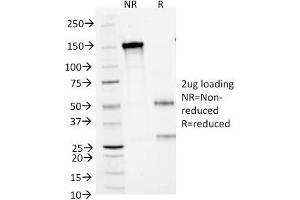 SDS-PAGE Analysis Purified CD1a Mouse Monoclonal Antibody (66IIC7). (CD1a antibody)
