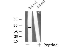 Western blot analysis of extracts from Jurkat cells, using KCNK6 antibody. (KCNK6 antibody  (C-Term))