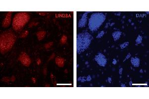 LIN28A antibody (pAb) tested by Immunocytochemistry Mouse embryonic stem cells (mESCs) grown on mouse embryonic fibroblast feeder cells (MEFs) were fixed with 4 % paraformaldehyde for 10 minutes at room temperature. (LIN28A antibody  (C-Term))