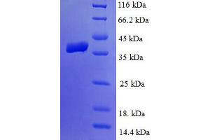 SDS-PAGE (SDS) image for Lipoic Acid Synthetase (LIAS) (AA 28-372) protein (His tag) (ABIN4976134) (LIAS Protein (AA 28-372) (His tag))