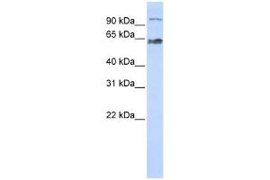 PPWD1 antibody used at 1 ug/ml to detect target protein. (PPWD1 antibody  (Middle Region))