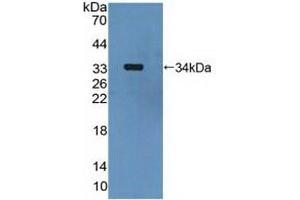 Western blot analysis of recombinant Human MAP2K6. (MAP2K6 antibody  (AA 46-306))