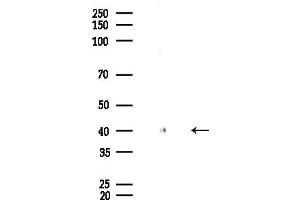 Western blot analysis of lysates from EC304 cells, using IL2RG Antibody at 1/1000 dilution.
