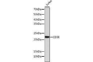 Western blot analysis of extracts of Jurkat cells, using CD3E antibody (ABIN7266185) at 1:1000 dilution. (CD3 epsilon antibody)