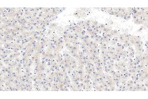 Immunohistochemistry (IHC) image for anti-beta-2-Microglobulin (B2M) (AA 22-119) antibody (ABIN7428731)