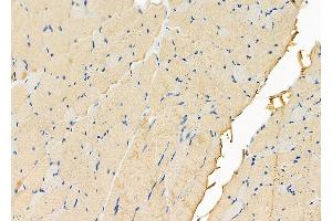 ABIN6261542 and ABIN6278459 at 1/100 staining Rat skin tissue by IHC-P.