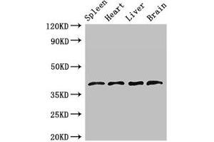 Western Blot Positive WB detected in: Rat spleen tissue, Mouse heart tissue, Mouse liver tissue, Mouse brain tissue All lanes: LEFTY1 antibody at 2. (LEFTY1 antibody  (AA 223-260))