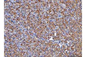 IHC analysis of RBP1 using anti-RBP1 antibody (ABIN7599586). (RBP1 antibody  (AA 10-135))