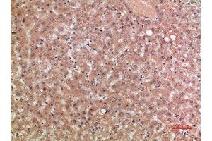 Immunohistochemical analysis of paraffin-embedded human-liver, antibody was diluted at 1:200 (CCR5 antibody  (AA 151-200))