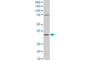 QPRT polyclonal antibody (A01), Lot # 060803QCS1 Western Blot analysis of QPRT expression in K-562 . (QPRT antibody  (AA 198-297))