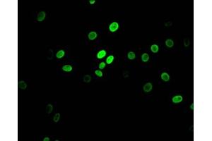 Immunofluorescence staining of HepG2 Cells with ABIN7127634 at 1:50, counter-stained with DAPI. (Recombinant MYBBP1A antibody)
