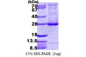 SDS-PAGE (SDS) image for ADP-Ribosylation Factor-Like 4A (ARL4A) (AA 1-200) protein (His tag) (ABIN7529175) (ARL4A Protein (AA 1-200) (His tag))