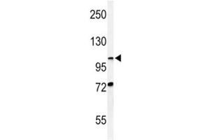 Western Blotting (WB) image for anti-Hypoxia Inducible Factor 1, alpha Subunit (Basic Helix-Loop-Helix Transcription Factor) (HIF1A) (AA 1-30) antibody (ABIN3031283)