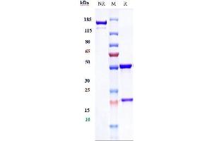 Anti-DCBLD2 / ESDN Reference Antibody (FA19-1) on SDS-PAGE under reducing (R) condition.