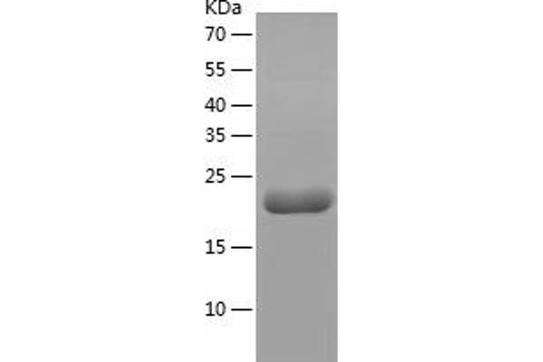 HSP90 Protein (AA 535-732) (His tag)