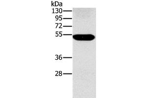Western Blot analysis of Human placenta tissue using FUCA1 Polyclonal Antibody at dilution of 1:500 (FUCA1 antibody)