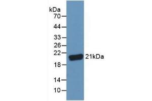 Detection of C8g in Human Serum using Polyclonal Antibody to Complement Component 8g (C8g) (C8G antibody  (AA 39-202))