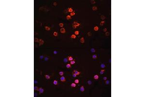 Immunofluorescence analysis of THP-1 cells using IL1β antibody (ABIN6128125, ABIN6142334, ABIN6142337 and ABIN6215185) at dilution of 1:100. (IL-1 beta antibody  (AA 124-223))