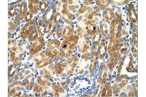 MAS1 antibody was used for immunohistochemistry at a concentration of 4-8 ug/ml. (MAS1 antibody  (Middle Region))