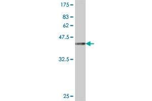 Western Blot detection against Immunogen (37. (SCAMP3 antibody  (AA 70-169))