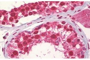Anti-CCNA1 antibody IHC staining of human testis. (Cyclin A1 antibody  (AA 411-460))