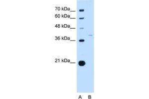 Western Blotting (WB) image for anti-Replication Factor C (Activator 1) 3, 38kDa (RFC3) antibody (ABIN2462934) (RFC3 antibody)