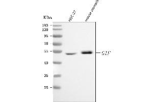 Western blot analysis of CBLIF using anti-CBLIF antibody (ABIN7599904). (CBLIF (AA 128-417) antibody)