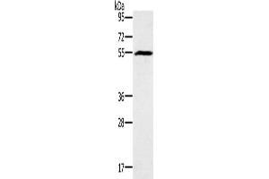 Western Blotting (WB) image for anti-Bone Morphogenetic Protein 6 (BMP6) antibody (ABIN2826750) (BMP6 antibody)