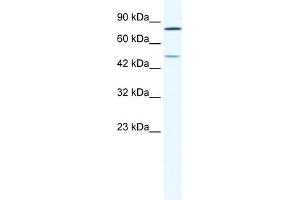 WB Suggested Anti-ZNF12 Antibody Titration:  1. (ZNF12 antibody  (N-Term))