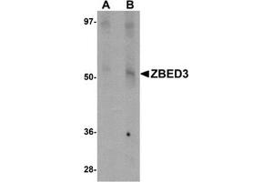 Western blot analysis of ZBED3 in rat lung tissue lysate with this product at (A) 1 and (B) 2 μg/ml. (ZBED3 antibody  (N-Term))