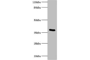 Western blot All lanes: Bordella pertussis pertussis toxin subunit 1 antibody at 2 μg/mL + recombinant Bordella pertussis pertussis toxin subunit 1 100 ng Secondary Goat polyclonal to rabbit IgG at 1/1000 dilution Predicted band size: 36 kDa Observed band size: 36 kDa (PtxA (AA 35-269) antibody)