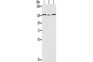 Gel: 6 % SDS-PAGE, Lysate: 40 μg, Lane 1-3: Hela cells, 231 cells, A172 cells, Primary antibody: ABIN7130904(RNF40 Antibody) at dilution 1/400, Secondary antibody: Goat anti rabbit IgG at 1/8000 dilution, Exposure time: 1 minute (RNF4 antibody)
