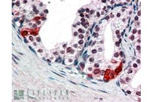 In paraffin embedded Human Prostate shows nuclear staining in secretory epithelial cells. (SMARCE1 antibody  (C-Term))