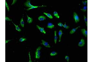 Immunofluorescence staining of U251 cells with ABIN7146077 at 1:250, counter-stained with DAPI. (CLEC4E antibody  (AA 41-219))