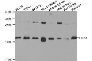 Western blot analysis of extracts of various cell lines, using SNX3 antibody. (Sorting Nexin 3 antibody)