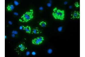 Anti-MYD88 mouse monoclonal antibody (ABIN2453996) immunofluorescent staining of COS7 cells transiently transfected by pCMV6-ENTRY MYD88 (RC202253). (MYD88 antibody)
