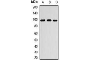 Western blot analysis of RANGAP1 expression in MCF7 (A), A549 (B), Jurkat (C) whole cell lysates. (RANGAP1 antibody)