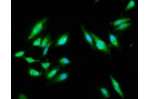 Immunofluorescence staining of Hela cells with ABIN7146907 at 1:100, counter-stained with DAPI. (CARD14 antibody  (AA 249-523))