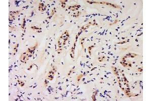 Formalin-fixed and paraffin embedded human kidney labeled with Anti-GSS/Glutathione Synthetase Polyclonal Antibody, Unconjugated  at 1:200 followed by conjugation to the secondary antibody and DAB staining. (Glutathione Synthetase antibody  (AA 81-160))