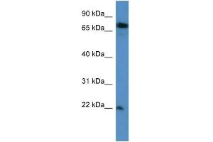 WB Suggested Anti-SFT2D3 Antibody Titration: 0. (SFT2D3 antibody  (N-Term))