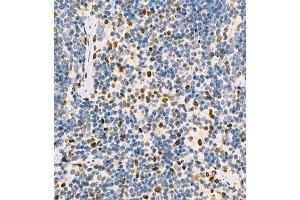 Immunohistochemistry of paraffin embedded mouse spleen using MNDA (ABIN7074709) at dilution of 1:2000 (400x lens) (MNDA antibody)